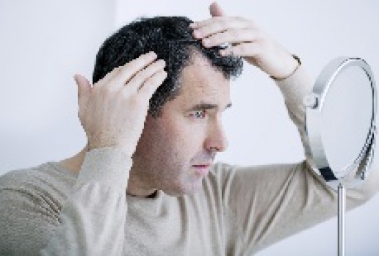 Haaruitval bestrijden met een voordelige haartransplantatie?